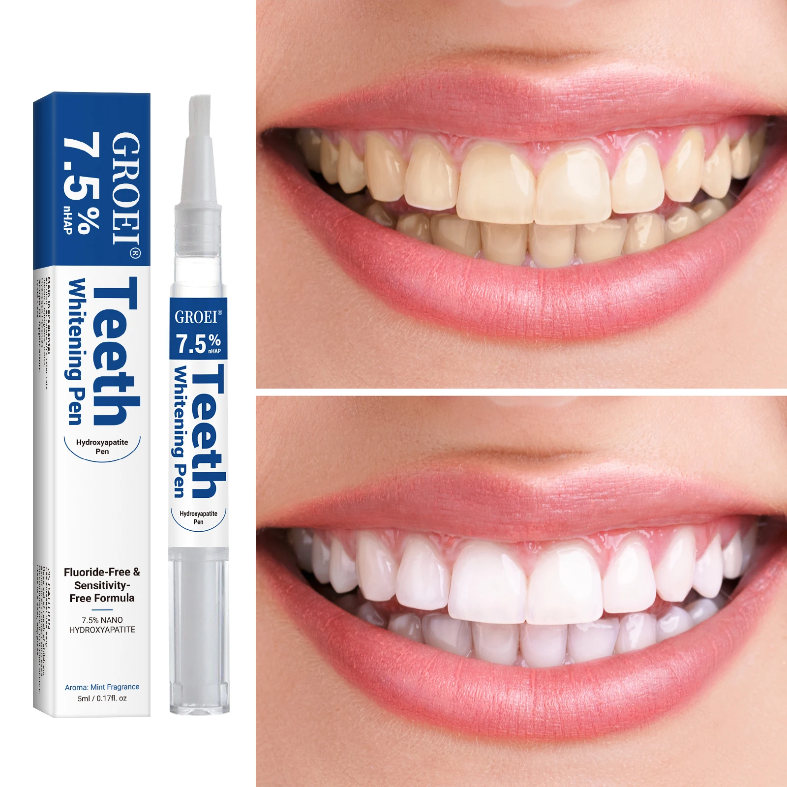 Hydroxyapatite Zahnaufhellungs – Teeth Whitening Session Bewertung und Preis