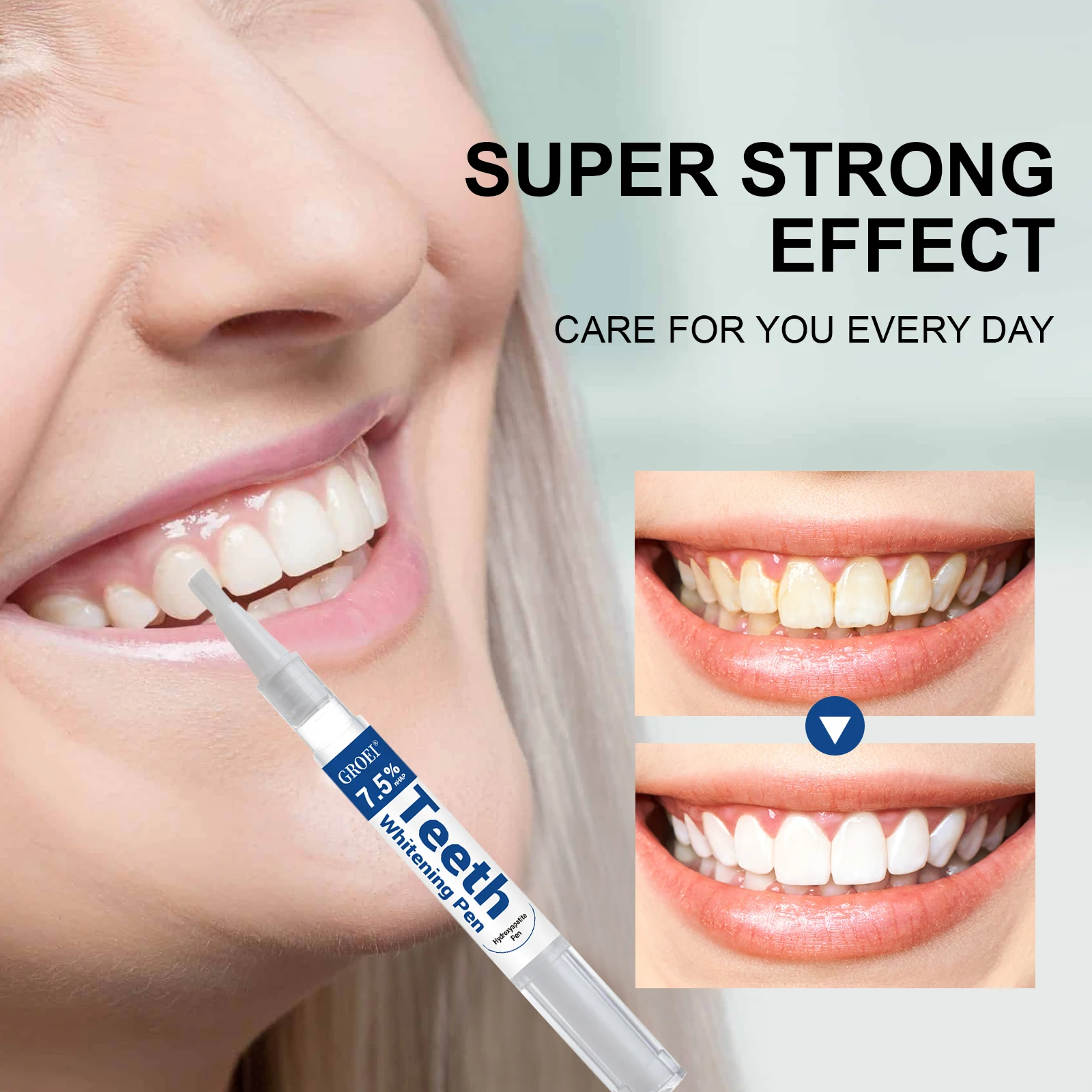 Hydroxyapatite Zahnaufhellungs – Teeth Whitening Session Bewertung und Preis