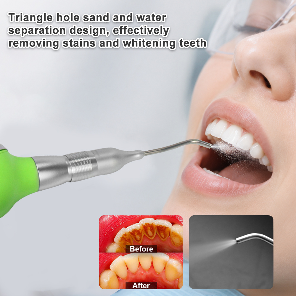 Dental-Luftpolierer mit Anti-R – Teeth Whitening Options Bewertung und Preis