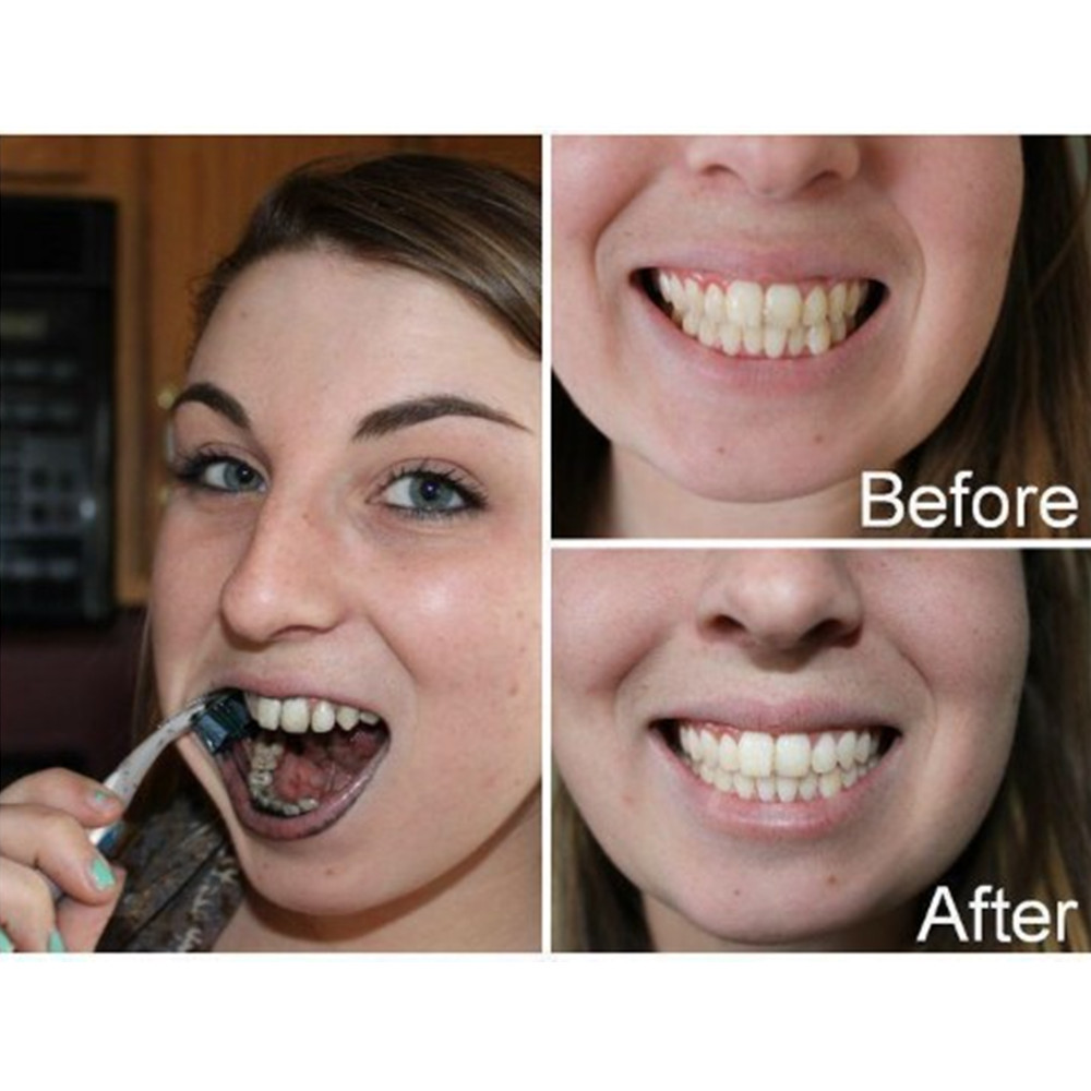 Bambus Holzkohle Zähne Zahn De – Teeth Whitening Co Bewertung und Preis