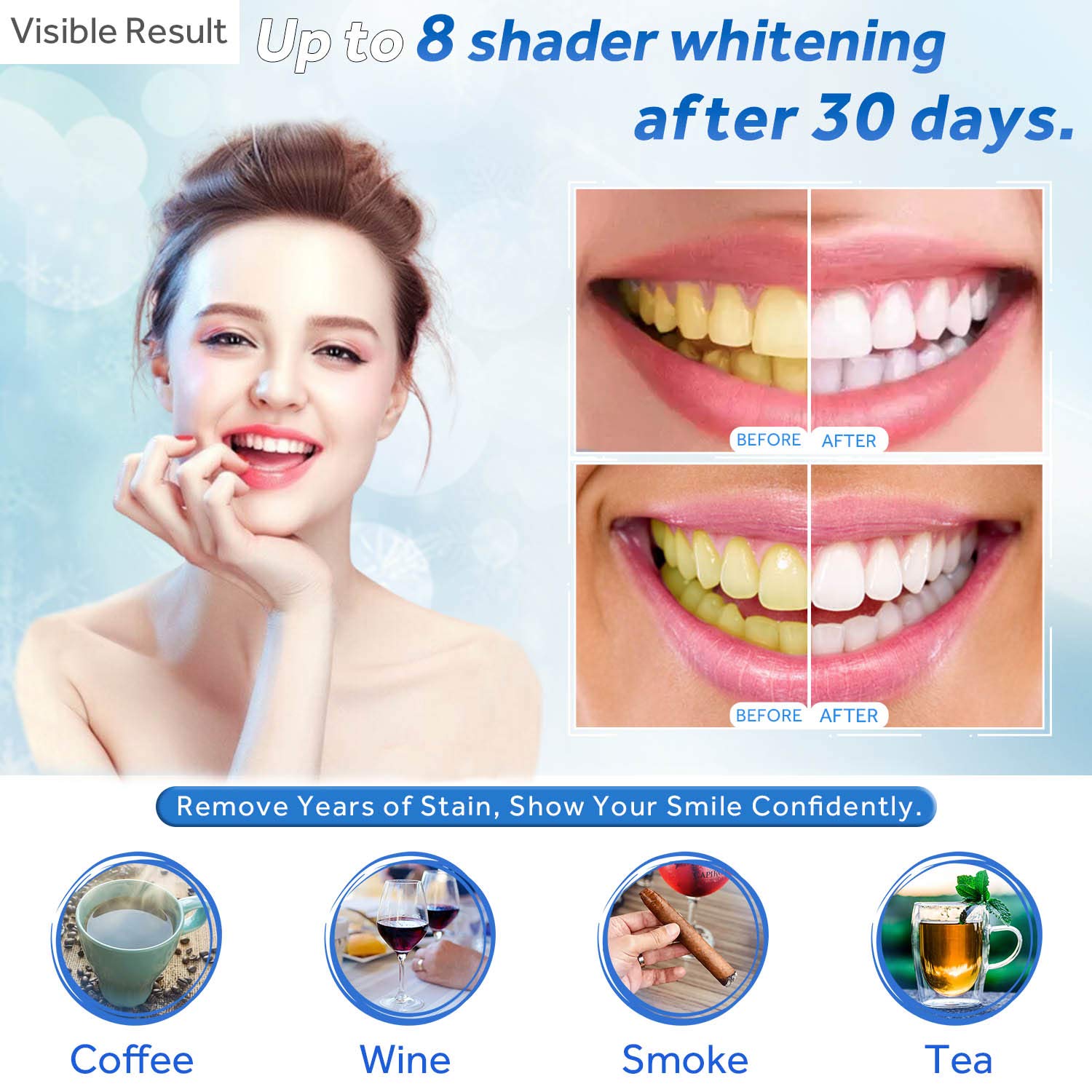 Zahnaufhellungsgel, Nachfüllsp – Teeth Whitening Session Bewertung und Preis