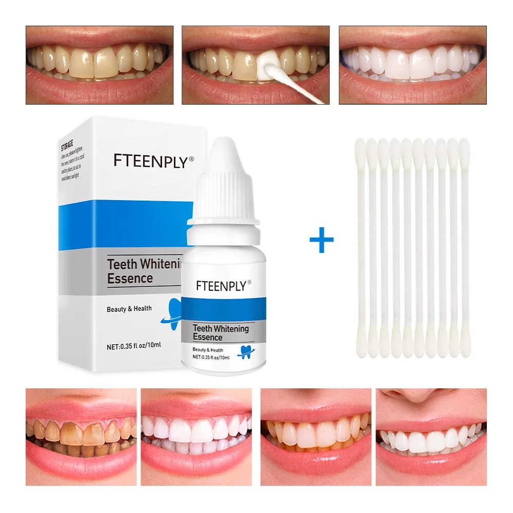 FTEENPLY Zahnaufhellung Essenz – Teeth Whitening Co Bewertung und Preis