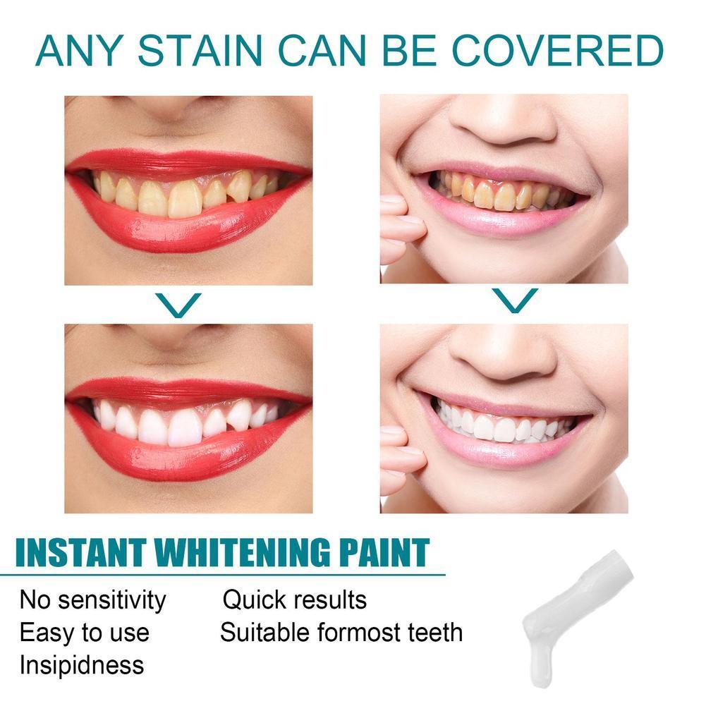 Zahnweiß-Farbe gegen Pigmentie – Teeth Paint Whitening Bewertung und Preis