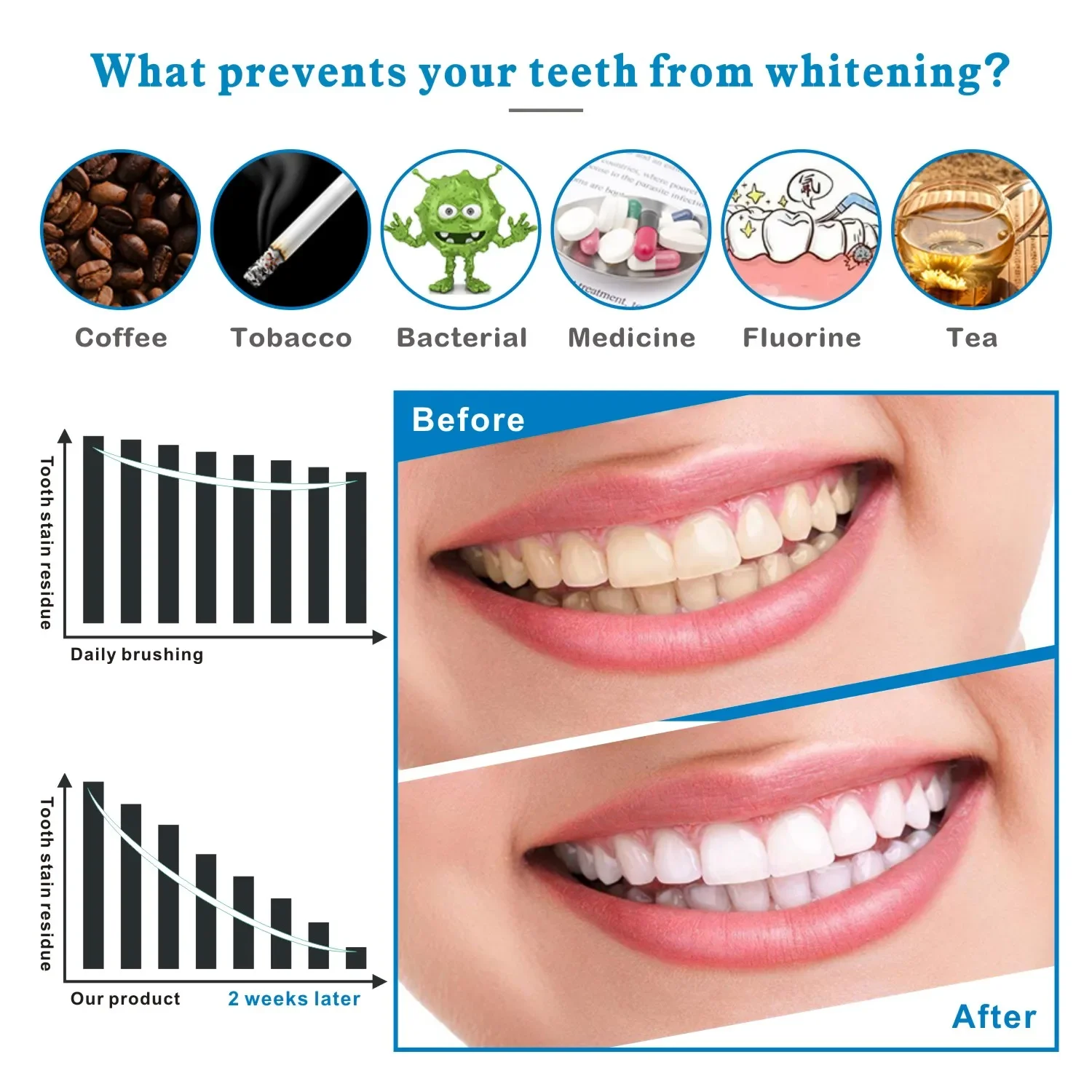 14/28 stücke 3D Zahnaufhellung – Whitening Strip 3D Bewertung und Preis