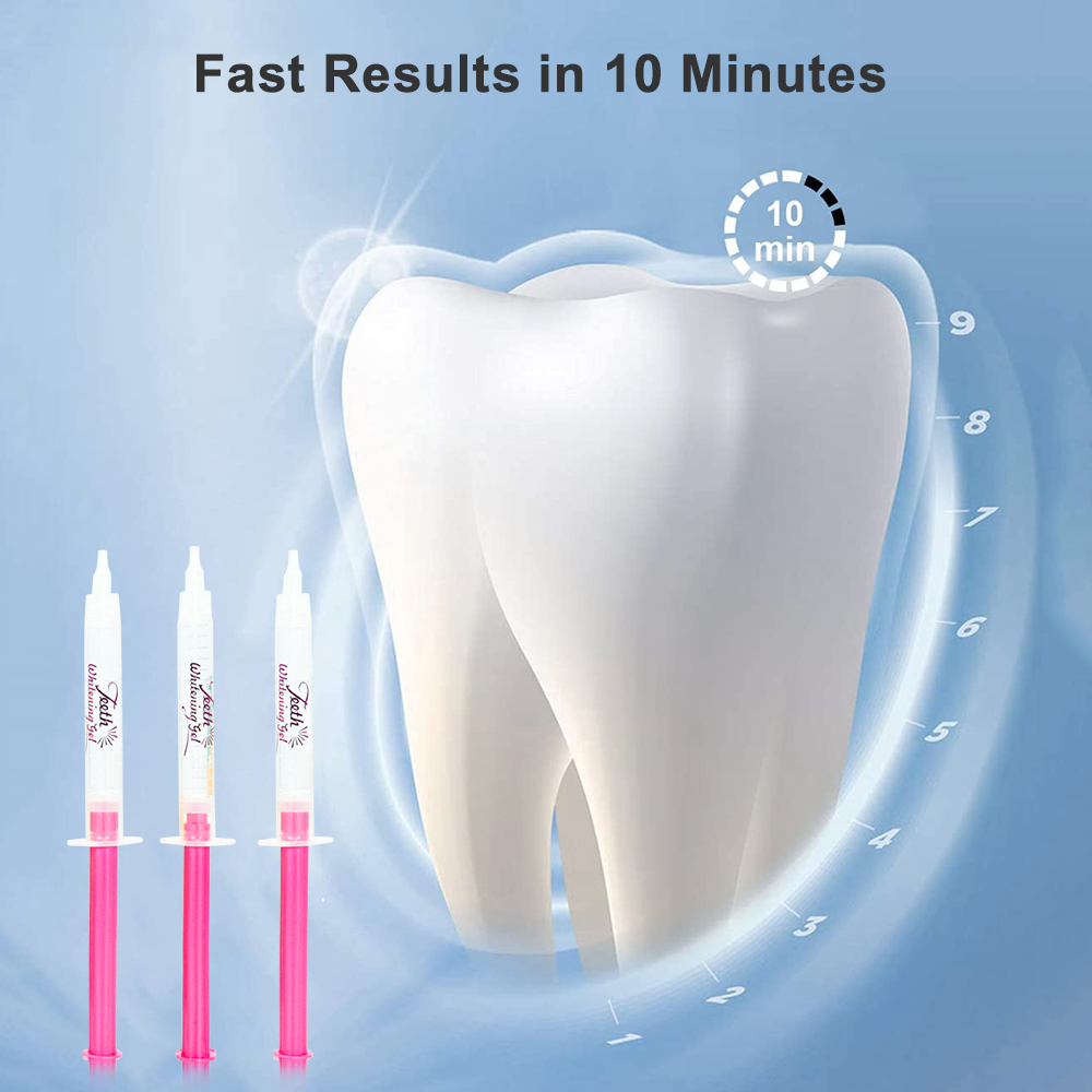 Zahnaufhellungsgel-Nachfüllset – Teeth Whitening Options Bewertung und Preis